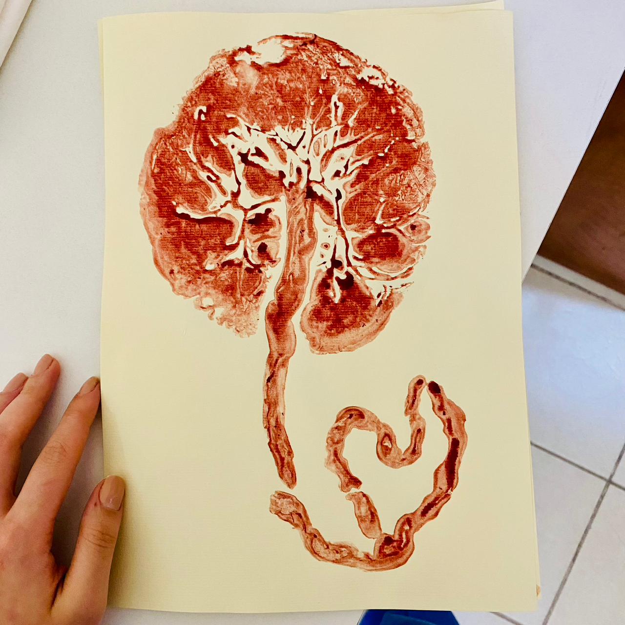 Placenta — registro especial